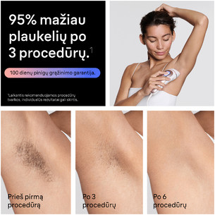 Braun Skin i·expert, baltas/rožinis - Fotoepiliatorius
