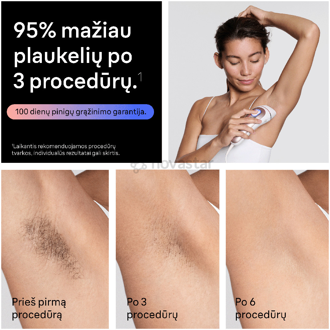 Braun Skin i·expert, baltas/rožinis - Fotoepiliatorius