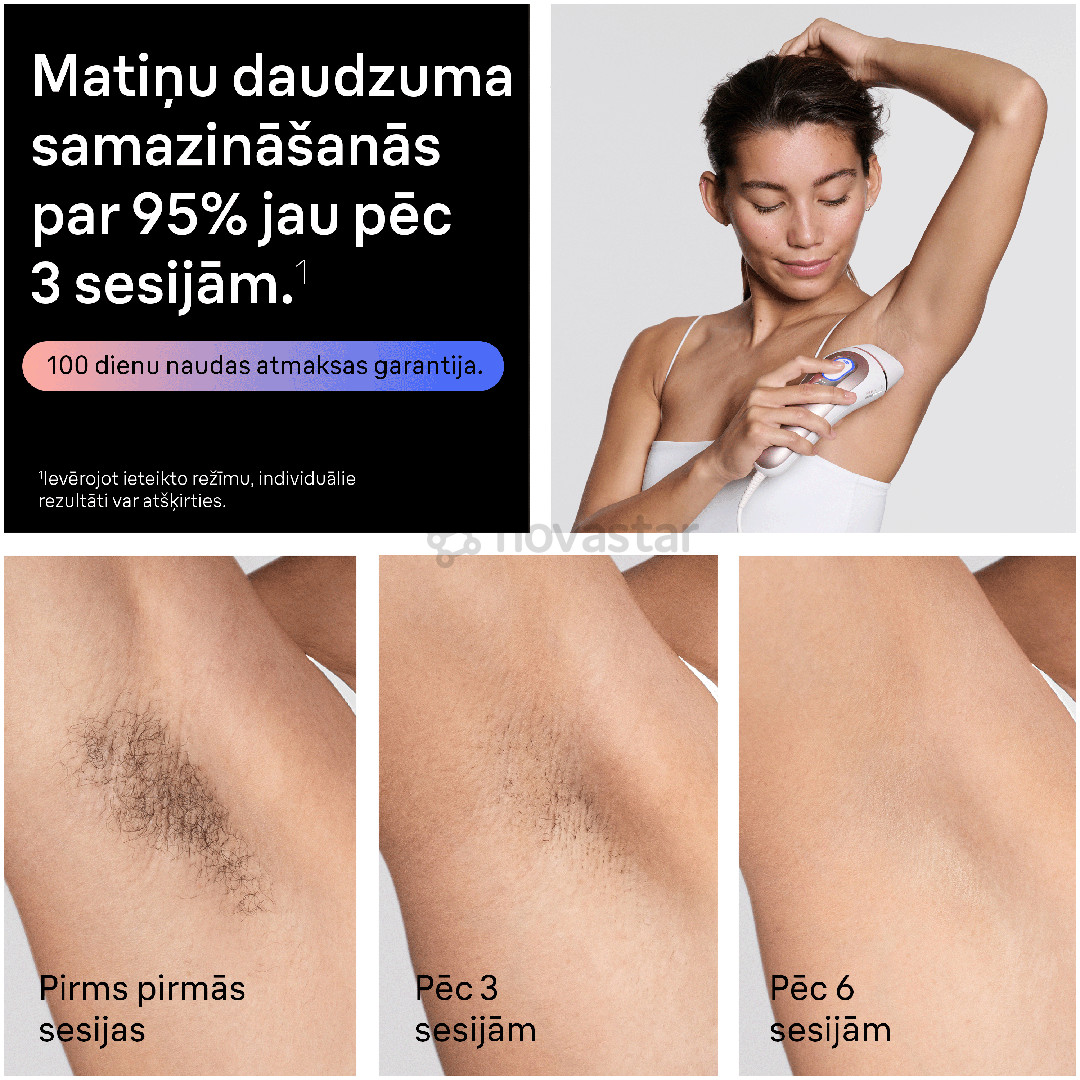 Braun Skin i·expert, baltas/rožinis - Fotoepiliatorius